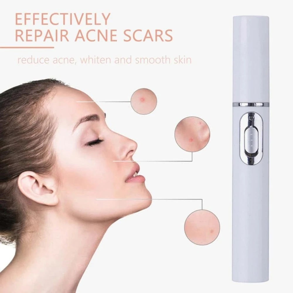 Blue Light Acne Laser Pen
